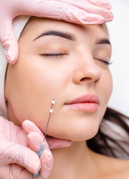 Trattamento Radiesse